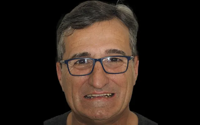 Clínica Dental Peyrí | Clínica Dental de Urgencias en Barcelona