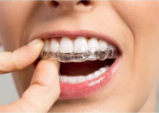 Clínica Dental Carmen Bernal
