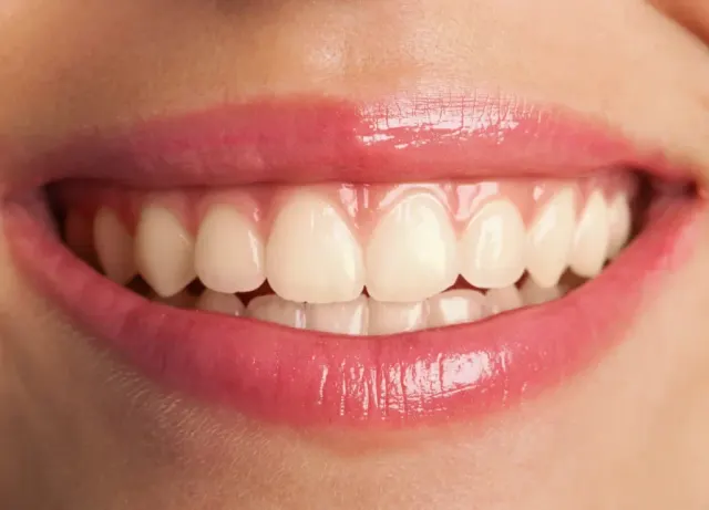 Dental Care Marbella